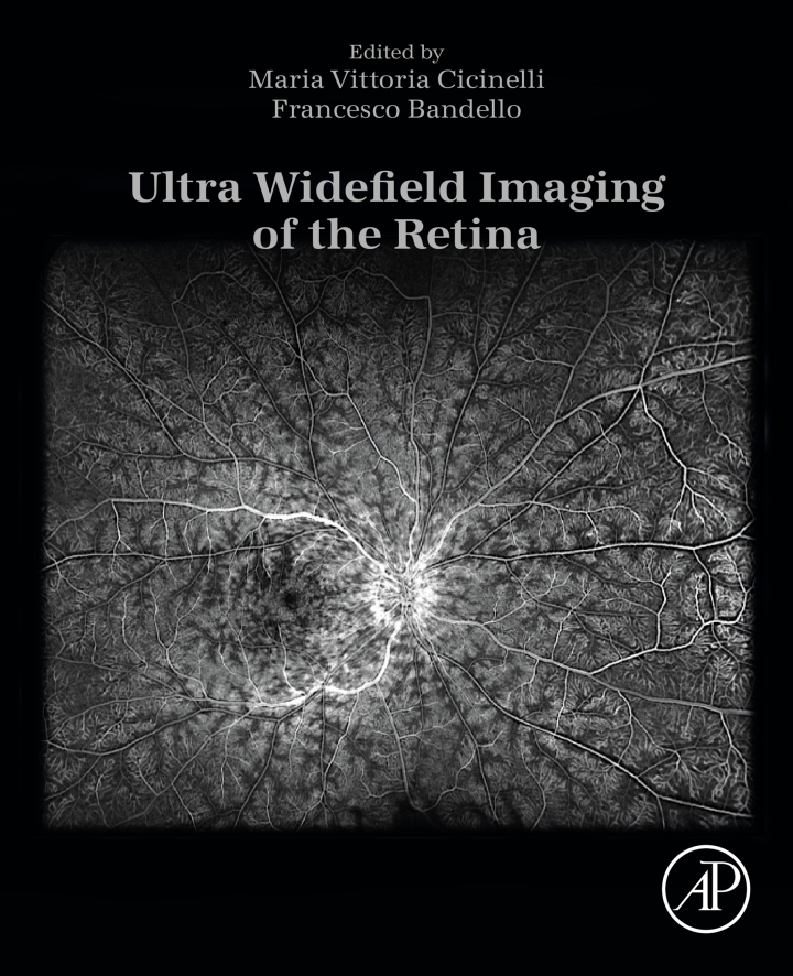 Ultra Widefield Imaging of the Retina